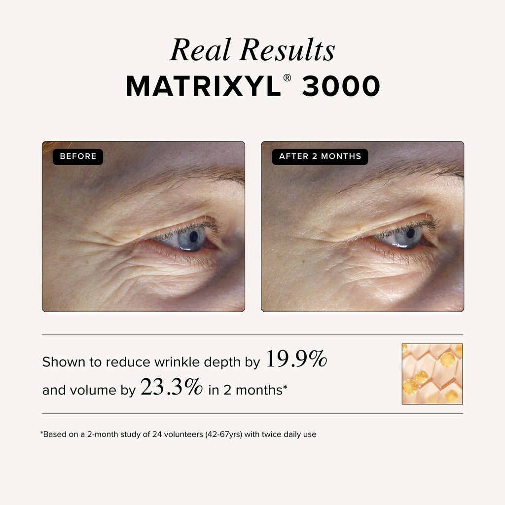 Asterwood Matrixyl 3000 + Argireline Serum for Face - Multi Peptide Serum with Hyaluronic Acid - Anti-Aging, Wrinkle Reducing, Collagen Boosting - Fragrance-Free - 1 Fl Oz