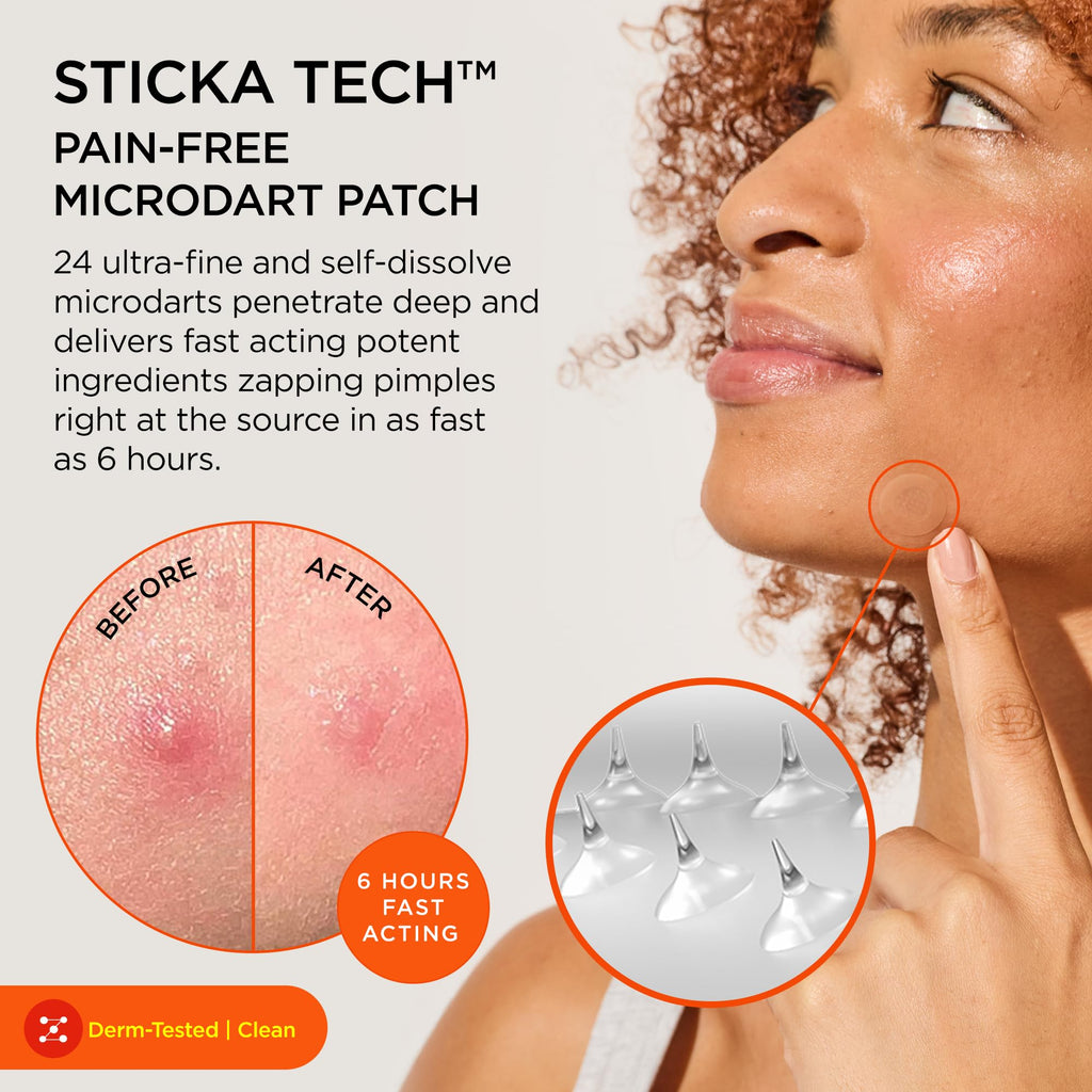 ZitSticka KILLA Kit Microdart Pimple Patches – Advanced Microdart Patch for Early-Stage Zits - Targeted ZitSticka Microdart Pimple Patch & Spot Patches for Breakout Control - 20 Count