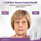 Beverly Hills V-Lift Instant Eye Lift and Eye Tuck Bee Venom Serum for Puffy Eyes, Dark Circles, Wrinkles, and Under Eye Bags Treatment for Women and Men | 30mL (120 Day Supply)