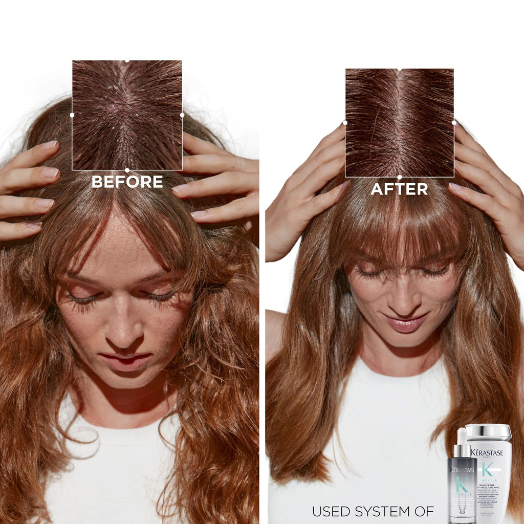 Kerastase Symbiose Scalp Renewal Micro-Exfoliating Scrub | For Scalps Prone to Dandruff | Purifies and Soothes | Helps Eliminate Signs of Dandruff | Formulated With Salicylic Acid | 6.8 Fl Oz
