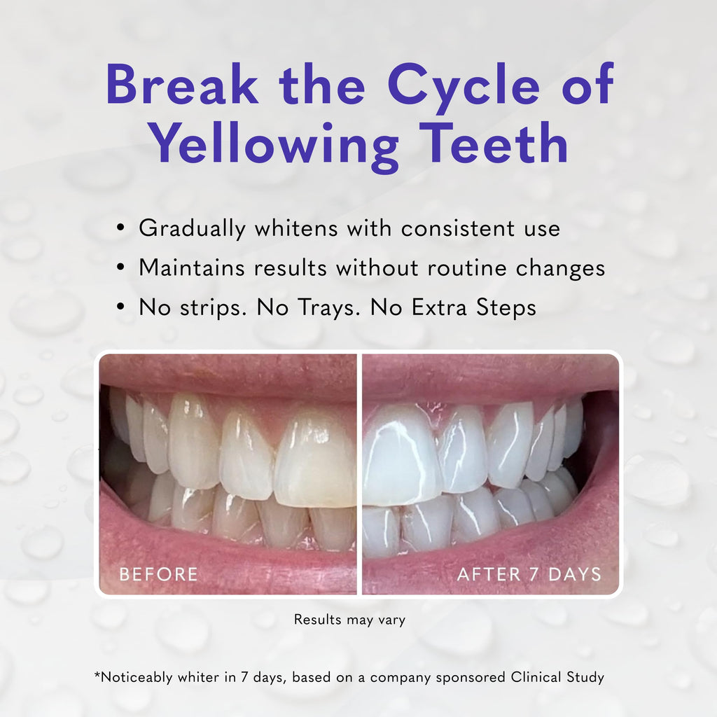 Smileactives Teeth Whitening Gel, Clinical-Grade Hydrogen Peroxide for Long Lasting White Teeth – Simply Add to Toothpaste to Permanently Remove Coffee Stains & More, 2 oz