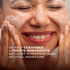 Murad Acne Control Clarifying Cream Cleanser – Gentle Salicylic Acid Face Wash for Acne-Prone and Sensitive Skin, Treats and Prevents Breakouts and Calms Irritation with Extra Hydration – 5 Fl Oz