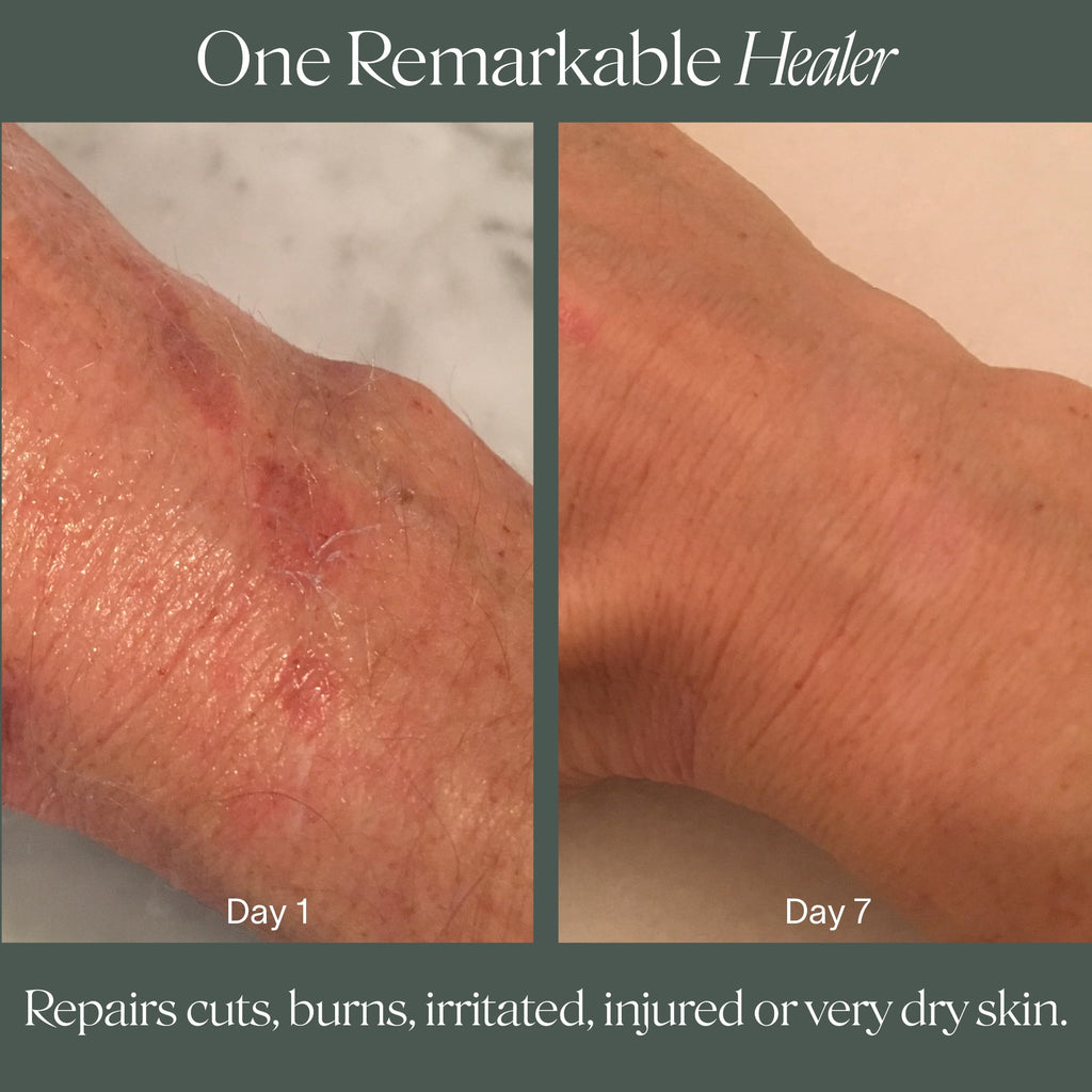 Doctor Rogers Restore Healing Balm. Multi-Purpose Healing Ointment & Moisturizing Relief Gel. Protects & Soothes Injured, Sensitive & Dry Skin. 4 Ounce (114 g) Tube