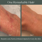 Doctor Rogers Restore Healing Balm. Multi-Purpose Healing Ointment & Moisturizing Relief Gel. Protects & Soothes Injured, Sensitive & Dry Skin. 4 Ounce (114 g) Tube