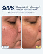 Remedy for Light Moisture | Barrier Repairing Hydrating Lightweight Gel Moisturizer Water Cream for Normal to Oily Skin | By Dermatologist Dr. Shah, 1.7 fl. Oz