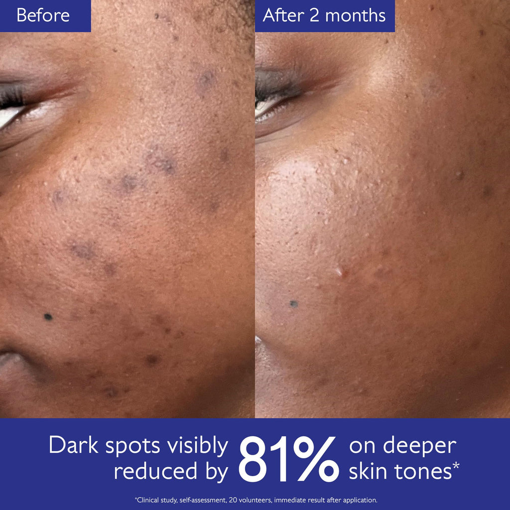 Caudalie Vinoperfect Brightening Dark Spot Serum Vitamin C Alternative - 62x More Effective than Vitamin C with Viniferine for a Visibly Brighter Even Complexion, 30 mL