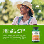 Swanson Beta-Carotene Vitamin A 25,000 IU Eye and Skin Health Supplement for Adults Seeking Vision and Immune Support - 7,500 mcg (300 Softgels)