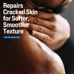 Cetaphil Cracked Skin Repair Lotion, 16 oz, For Very Rough & Cracked, Sensitive Skin, 24 Hour Hydration, Protects & Hydrates Cracked Skin, Hypoallergenic, Fragrance Free