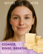Candida Freedom Massey’s CF 100% Natural Probiotic Soap - Powerful Tea Tree and Lemon Body Soap - 4oz Lemon Scent
