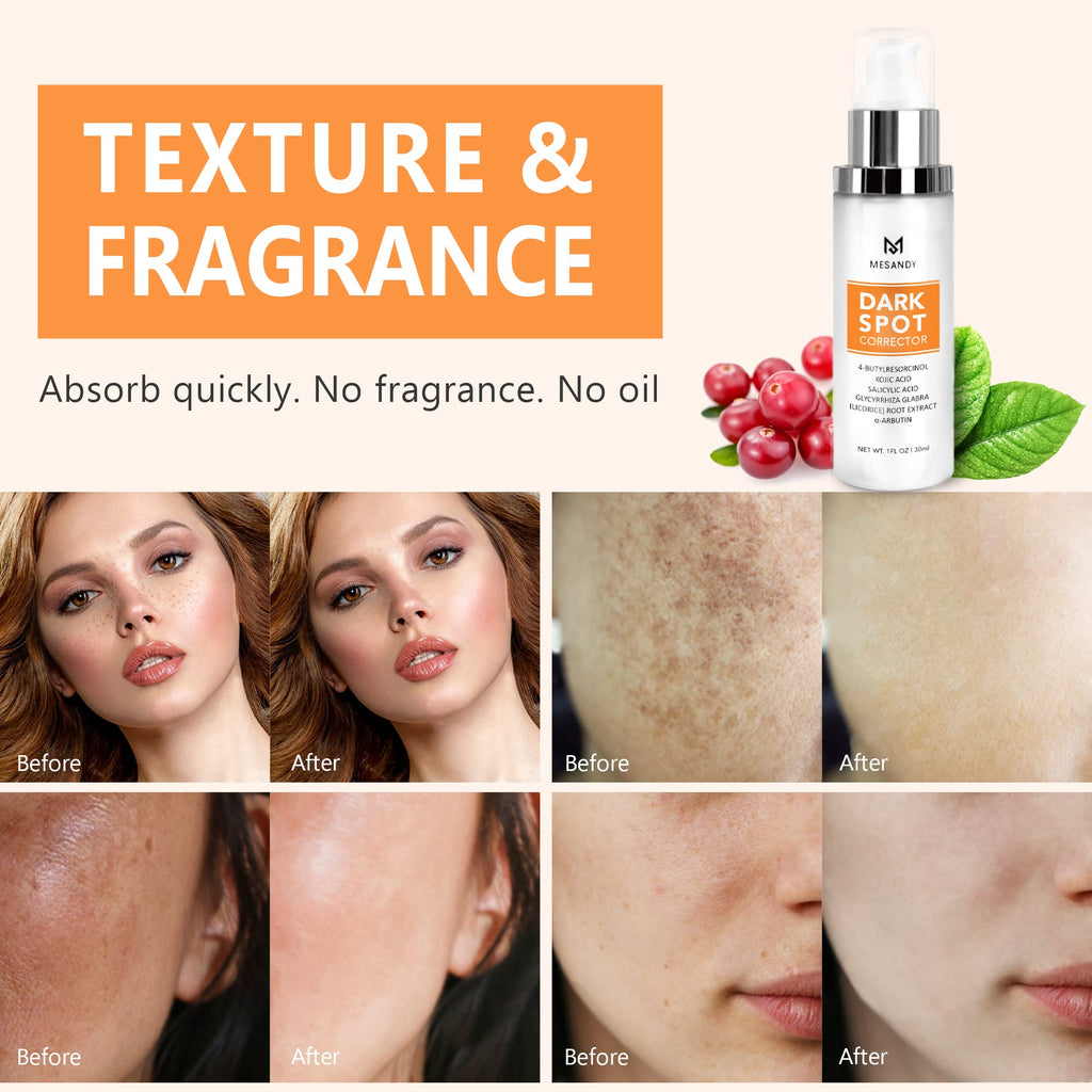 Dark Spot Corrector, Dark Spot Remover For Face and Body Serum | Improves Hyperpigmentation, Facial Freckles, Melasma, Brown Spots