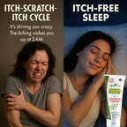 Oleavicin Organic Extra Strength Anti-Itch Cream for Dry, Itchy Skin Relief Natural Fungal & Rash Treatment with Olive Leaf Extract Fast-Acting, Long-Lasting Relief