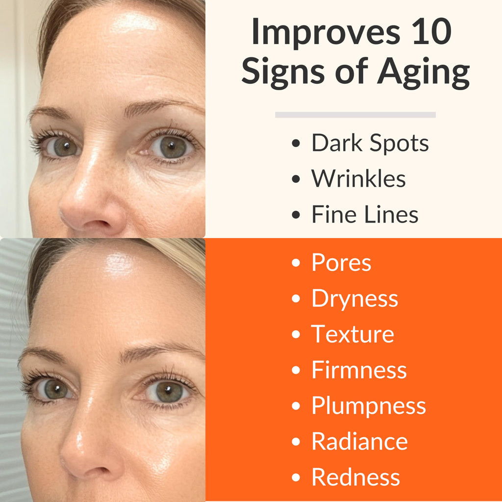 LeVaye Vitamin C Serum, Anti-Aging Face Serum – 15% Vitamin C, Ferulic Acid, Niacinamide, Hyaluronic Acid, Peptides, Ceramides – Targets Wrinkles, Fine Lines, Dark Spots, Enlarged Pores, Dry Skin