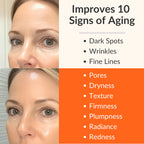 LeVaye Vitamin C Serum, Anti-Aging Face Serum – 15% Vitamin C, Ferulic Acid, Niacinamide, Hyaluronic Acid, Peptides, Ceramides – Targets Wrinkles, Fine Lines, Dark Spots, Enlarged Pores, Dry Skin