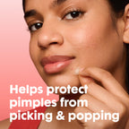 Mighty Patch Hero Cosmetics Original Nighttime Acne Pimple Patches, 75 Ct