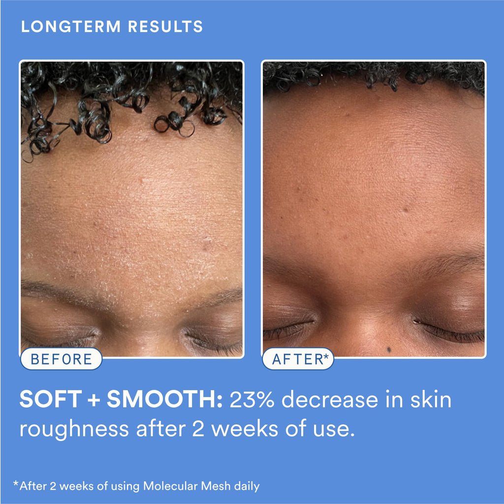 Experiment Molecular Mesh Barrier Repair Face Moisturizer - Soothing Lightweight Face Cream for Strength, Redness, & Irritation - Ectoin, Phytosphingosine, Centella 2 FL OZ - Vegan for Sensitive Skin