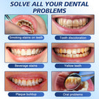 Tooth Paint - Instant Teeth Whitening Paint for Yellow Teeth, Smokers and Coffee Lovers, Creates a Dazzling White Smile in Minutes-GQLJ
