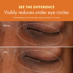 Origins GinZing Brightening Eye Cream with Vitamin C & Niacinamide| Visibly Reduces Dark Circles, Warm, 0.5 Fl Oz