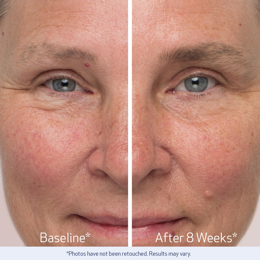 Obagi Medical Nu-Cil Eyebrow Boosting Serum, Pack of 2