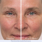 Obagi Medical Nu-Cil Eyebrow Boosting Serum, Pack of 2
