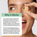 CLEARSTEM - MINDBODYSKIN Hormonal Acne Supplement (No 5-HTP) - Natural DIM Supplement - Skin Care Vitamins - Hormone Balance, Antioxidants - Gluten Free, Cruelty Free - 30 Servings, 90 Capsules