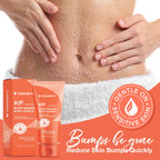 Skin Care Set- KP Bump Eraser Body Scrub and the Stretch Mark Prevention Cream
