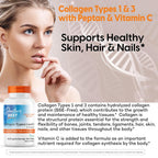 Doctors Best Collagen Types 1 and 3 & Vitamin C, Supports Hair, Skin, Nails, Bones, & Joints, Non-GMO, Gluten Free, Soy Free 540 Tablets
