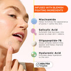 ZitSticka Killa Microdart Pimple Patches for Face - Most Potent Pimple Patch with Fast-Acting Microdarts - For Deep, Early-Stage Zits with Salicylic Acid - Regular 8 Count with Cleaning Swab