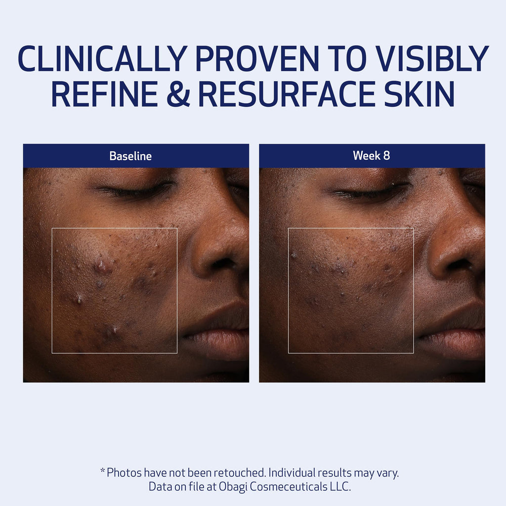 Obagi Medical Retinol + PHA Refining Night Cream - Clinically Proven, Dual-Action, Overnight Anti-Aging Face Cream for Smoother, Renewed Skin & a More Even-Looking Complexion - 1.7 Oz