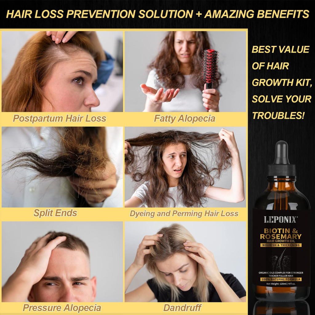 Rosemary Oil for Hair Growth, 120ml Diluted Rosemary Oil Hair Growth Serum with Derma Roller & Scalp Massager Hair Thickening Products Hair Loss Treatment for Men Women, Mens Gift Set