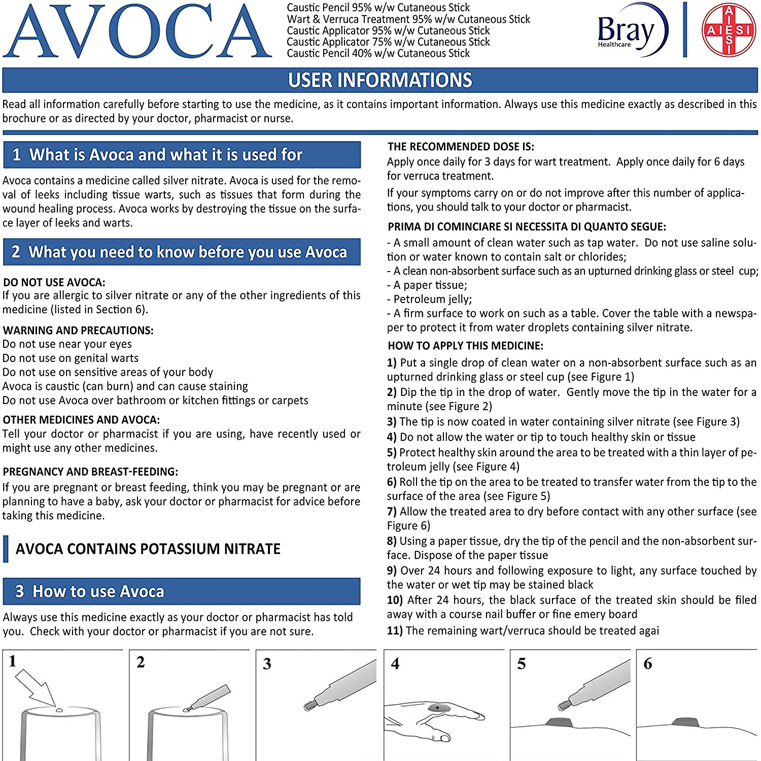 Avoca 40% Silver Caustic Pencil for Removal of Warts and Textiles 2 Pieces