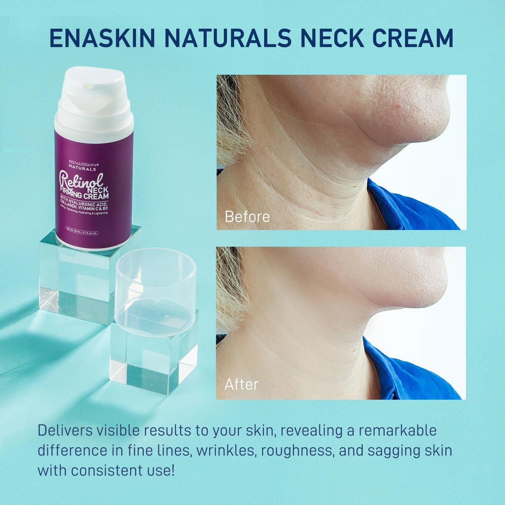 Retinol Neck Firming Cream: Advanced Face Tightening and Lifting Cream with Hyaluronic Acid, Collagen and Vitamin - Tightening Wrinkles, Firming Sagging Skin on Face, Neck, Décolleté - 2.7 Oz