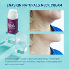 Retinol Neck Firming Cream: Advanced Face Tightening and Lifting Cream with Hyaluronic Acid, Collagen and Vitamin - Tightening Wrinkles, Firming Sagging Skin on Face, Neck, Décolleté - 2.7 Oz