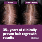 Women's Rogaine 5% Minoxidil Topical Foam, Unscented, 2 x 2.11 oz