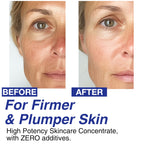 Volufiline 100% Concentrate Firming Serum for Sagging Skin – Face Tightening, Jawline & V-Line Contour Booster, Anti-Wrinkle Collagen Enhancer | Fast-Absorbing Mix-in Korean Skincare