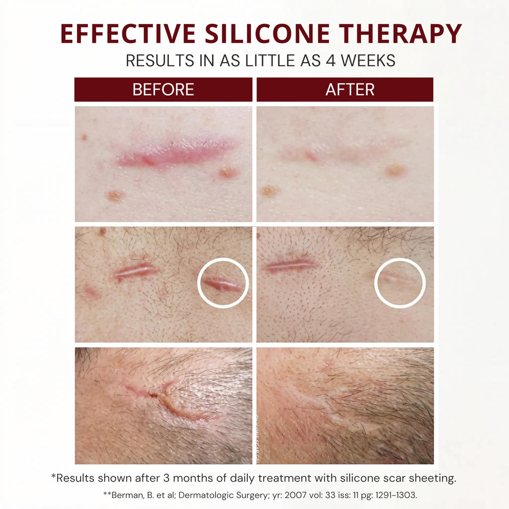 HealFast Silicone Scar Gel & Cream for Surgical Scars - Medical Grade Scar Treatment & Removal for Keloid, Acne, Burns, C Section, Stretch Marks - Physician Formulated Advanced Silicone Gel for Scars