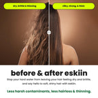 Eskiin Shower Head Water Filter Replacement For The Eskiin Showerhead - High Pressure Shower Heads Replacement For Smooth Hair & Skin - Replacement Cartridge Fits The Eskiin Filtered Shower Head