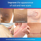ScarAway Silicone Scar Gel, Helps Improve Size, Color & Texture of Hypertrophic & Keloid Scars from Injury, Burns & Surgery, Water Resistant, 20g (0.7 Oz)