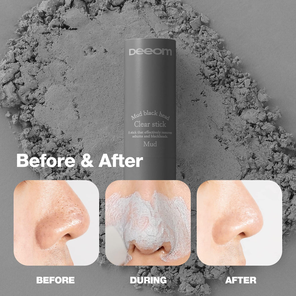 DEEOM Blackhead Remover Stick, Deep Pore Cleansing Charcoal Stick for Blackheads & Whiteheads, Exfoliating Pore Cleanser, Oil & Sebum Control, 14g