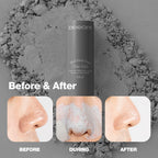 DEEOM Blackhead Remover Stick, Deep Pore Cleansing Charcoal Stick for Blackheads & Whiteheads, Exfoliating Pore Cleanser, Oil & Sebum Control, 14g