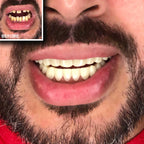 Instant Smile Comfort Fit Flex Teeth - Top & Bottom Matching Set Natural Tone Fix Your Smile At Home Within Minutes
