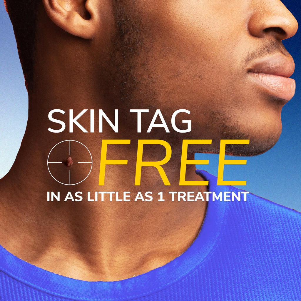 Dr. Scholl's Freeze Away Skin Tag Remover Kit, 8 ct – Completely removes Skin Tags in As Little As 1 Treatment, FDA-Cleared & Clinically Proven At-Home Removal, Easy 1-Handed Action, Permanent Results