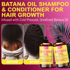 Rida Hair Research Institute Batana Oil Shampoo & Conditioner Set for Hair Growth Lightening Thinning Hair for Men and Women