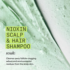 NIOXIN System 2 | Scalp Care | Shampoo | Hair Thickening | For Natural Hair