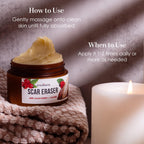 Better Shea Butter Scar Eraser Balm - Cocoa Butter Cream for Stretch Marks and Dark Spots, Burns, Old Scars - Acne Scars - Designed w Zero Synthetic Ingredients, 4 oz
