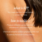First Aid Beauty - KP Bump Eraser Body Scrub with 10% AHA, Keratosis Pilaris Skin Exfoliater with Glycolic and Lactic acids, Helps Reduce Chicken Skin Bumps, Safe for Sensitive Skin, 8 oz + Bonus, 2ct