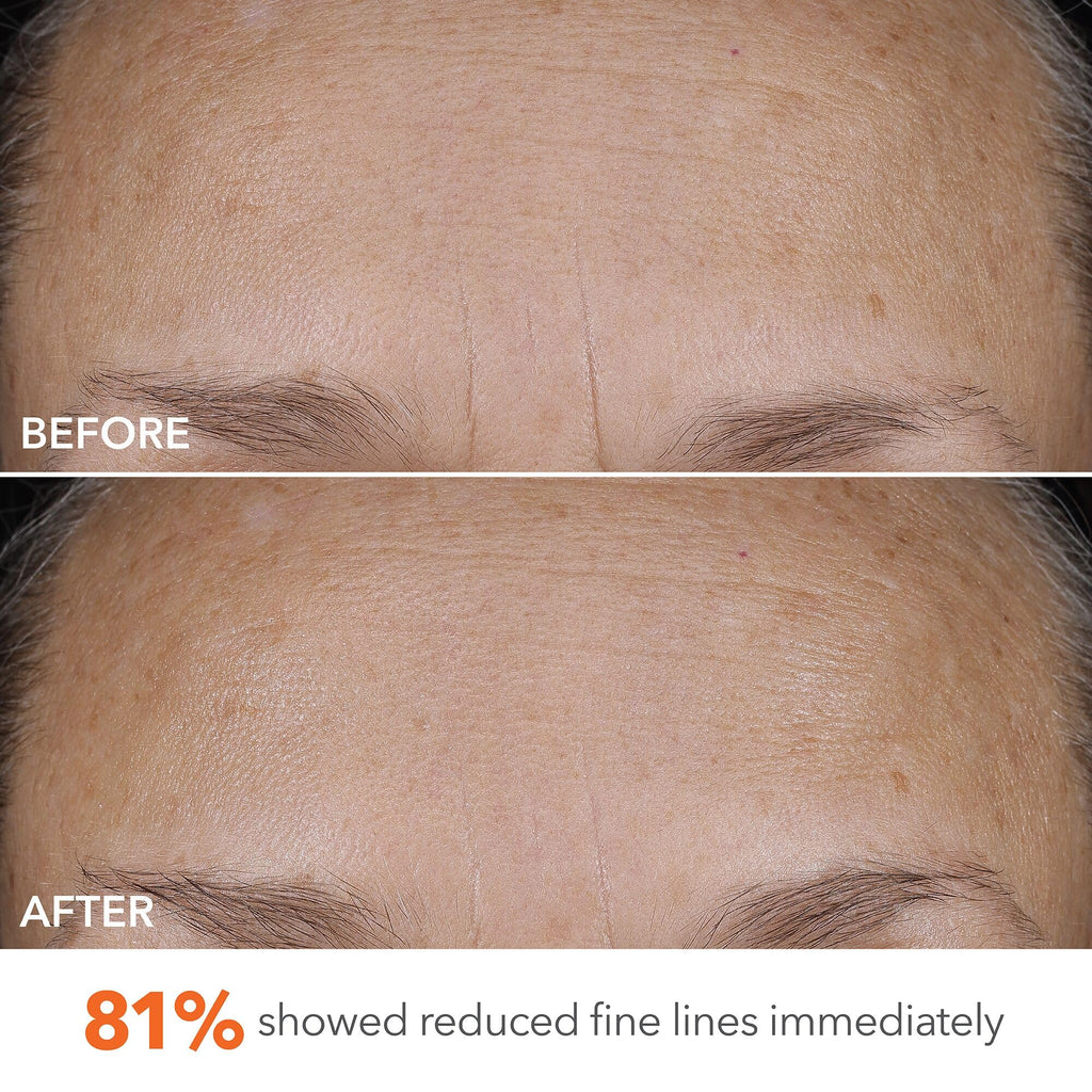 Dr Dennis Gross DermInfusions Blur + Repair Cream, Instantly Blurs Fine Lines, Smooths Skin with Satin-Matte Finish, Visibly Plumps & Firms & Improves Skin Elasticity, 0.67 Fl Oz