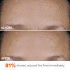 Dr Dennis Gross DermInfusions Blur + Repair Cream, Instantly Blurs Fine Lines, Smooths Skin with Satin-Matte Finish, Visibly Plumps & Firms & Improves Skin Elasticity, 0.67 Fl Oz