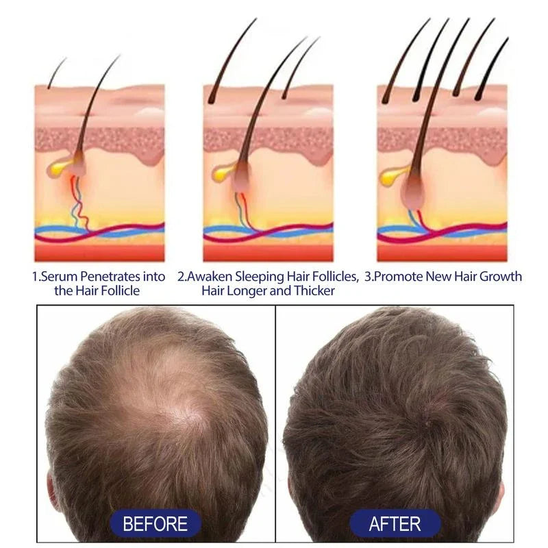 East Moon Men'S Hair Thickening Foam | Plant-Based Formula For Stronger Strands & Scalp Nourishment