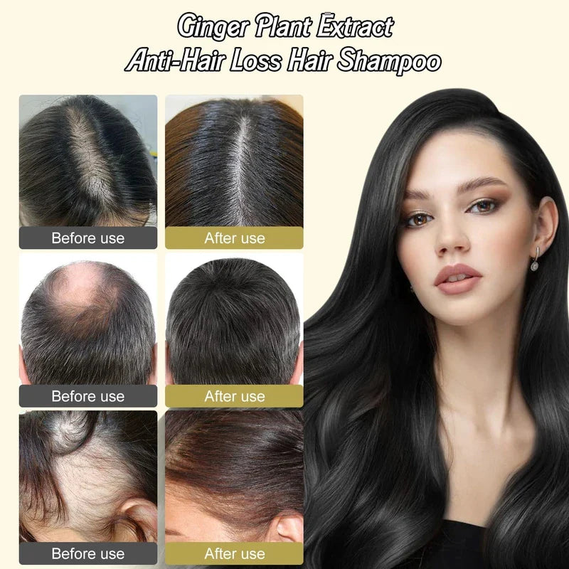 YCNASSS 2PCS Ginger Plant Extract Anti-Hair Loss Hair Shampoo,Identicalven Hair Loss Shampoo, Anti-Dandruff Shampoo, Polygonum Multiflorum Oil Control Shampoo for Hair Growth