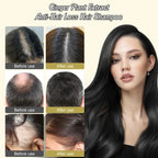 YCNASSS 2PCS Ginger Plant Extract Anti-Hair Loss Hair Shampoo,Identicalven Hair Loss Shampoo, Anti-Dandruff Shampoo, Polygonum Multiflorum Oil Control Shampoo for Hair Growth